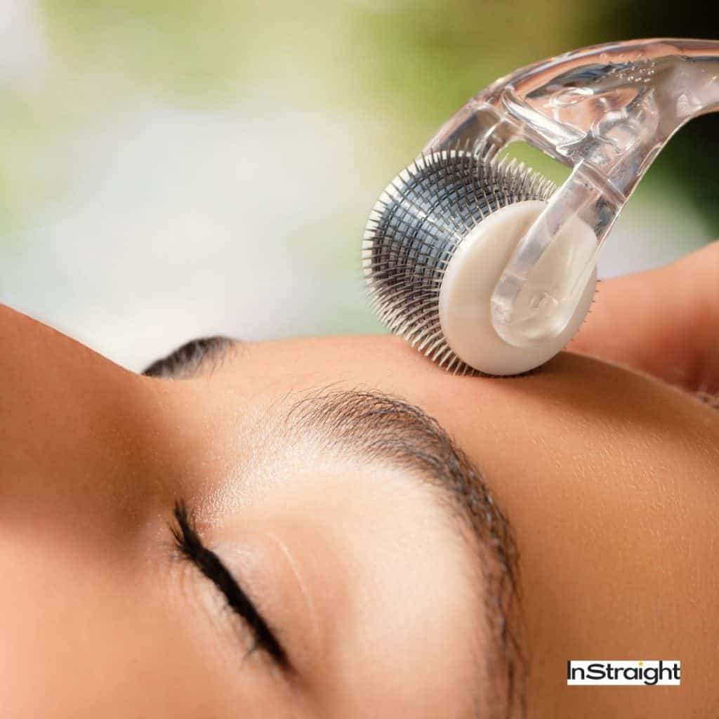 derma roller on the lady's forehead